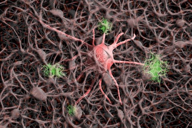 sagligagel-alzheimer-hastaligi-bulasici-mi84