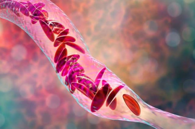 sagligagel-ferritin-nedir-ferritin-eksikligi-neden-olur3