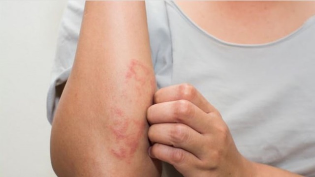 sagligagel-cilt-hastalıkları-ve-belirtileri-nelerdir