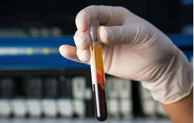 sagligagel-k-vitamini-ne-ise-yarar-k-vitamini-eksikligi5-1