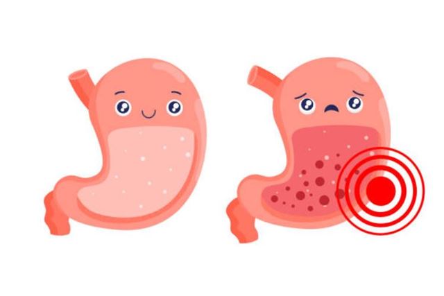 sagligagel-gastrit-ilaclari-nedir-gastritis-nasil-iyilesir3