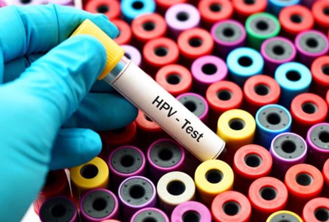 sagligagel-tehlikeli-hpv-virusu-nedir-hpv-virusu-tedavisi143