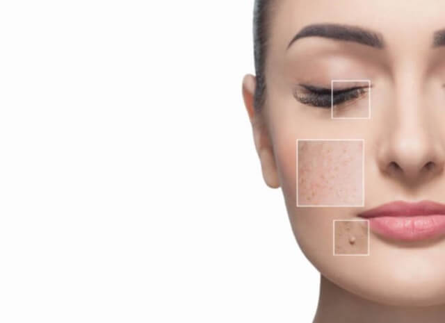 sagligagel-actinoma-jel-fiyat-2022-actinoma-jel-ne-ise-yarar