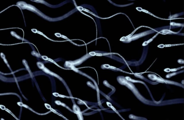 sagligagel-sperm-kalitesi-nedir-02