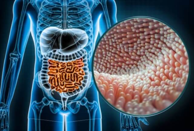 sagligagel-dermatitis-herpetiformis-nedir-5