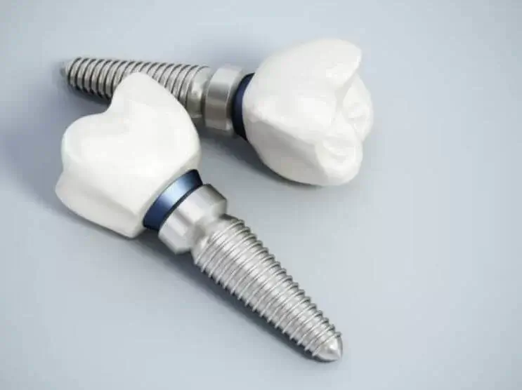 sagligagel-ankara-implant-tedavisi-3