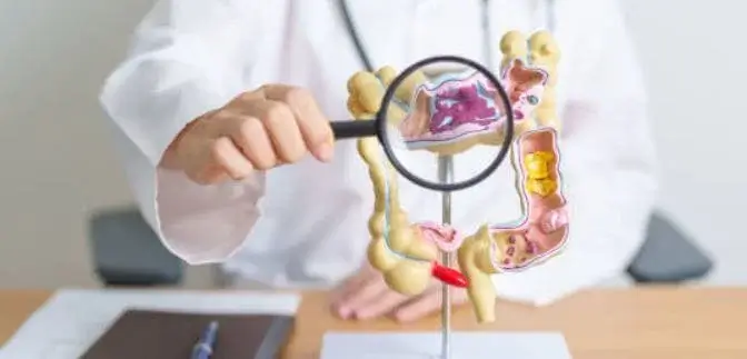sagligagel-crohn-hastaligi-nasil-anlasilir-2