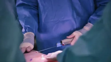 sagligagel-lipo-ameliyatindan-sonra-3