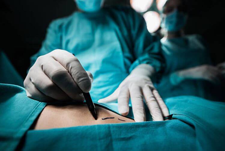 sagligagel-lipo-ameliyatindan-sonra-7
